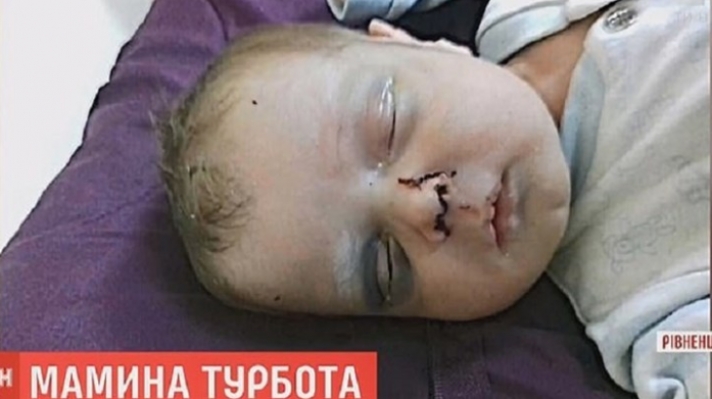 Φρίκη στην Ουκρανία: Μητέρα έσπασε στο ξύλο το ενός μηνός μωρό της - Δίνει μάχη για τη ζωή του - ΦΩΤΟ